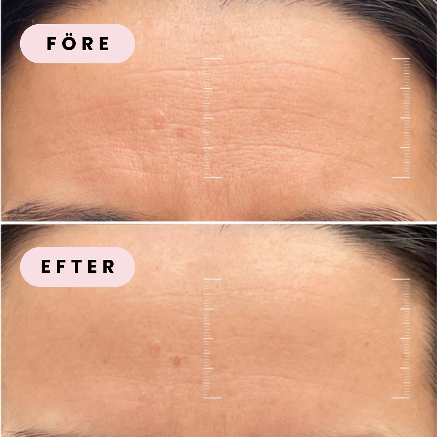 Lymiq – Peel off Bio kollagenmask