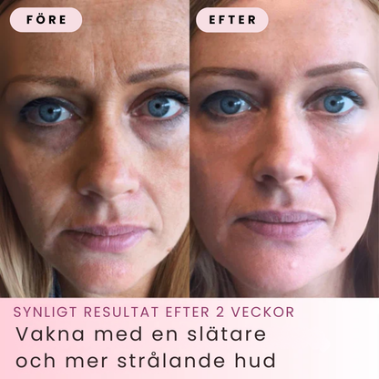 Lymiq – Peel off Bio kollagenmask